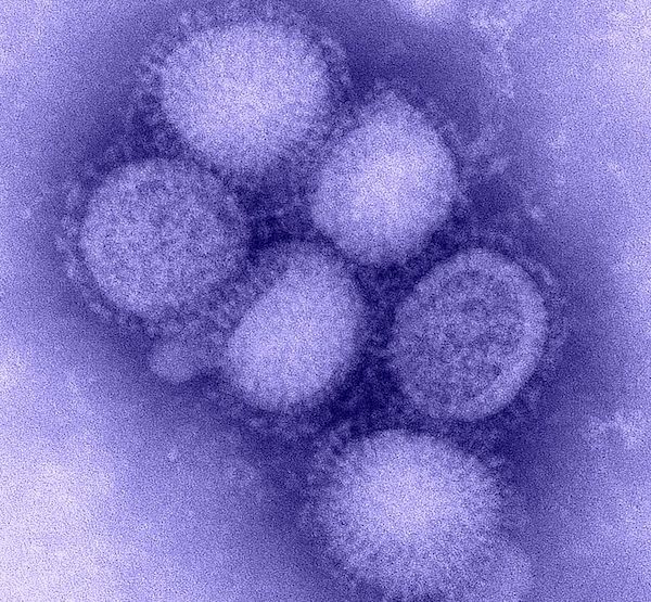 H1N1 인플루엔자 바이러스